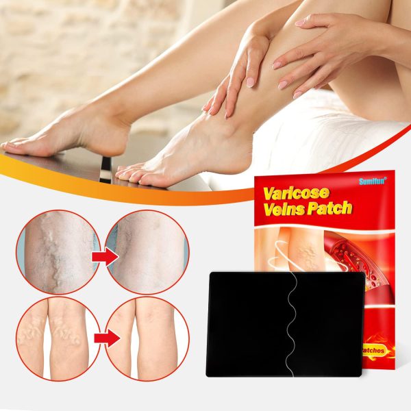 sumifun varicose veins patch 5