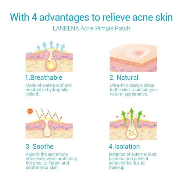 Lanbena Acne Pimple Patch Daily Use 25 Patches 4