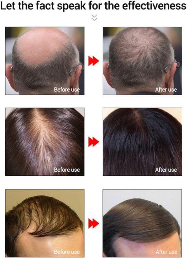 Lanbena Hair Growth Essential Oil 3