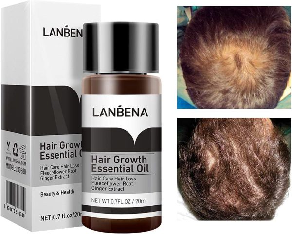 Lanbena Hair Growth Essential Oil 5