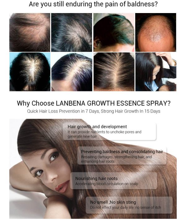 Hair Growth Essence Spray 3