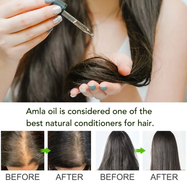 Aliver Amla Oil For Hair 9