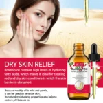 Aliver Rosehip Oil For Face, Hair & Body