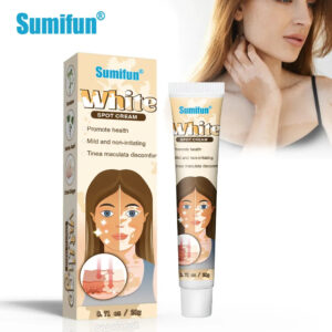 Sumifun White Spot Cream, Vitiligo Removal Cream 20g