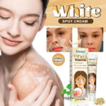Sumifun White Spot Cream, Vitiligo Removal Cream 20g