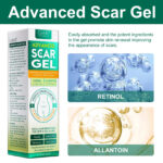 Elaimei Advanced Scar Gel 50ml 3 Elaimei Advanced Scar Gel 50ml