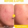 TIRTIR Pure Vitamin C 24 Face Serum – Dark Spot Remover for Sensitive Skin with Collagen Anti Aging Even Out Skin Tone Non Irritation Tested, Wrinkles, Korean Mild Vita C Facial Serum 1.01 Fl Oz 30ML