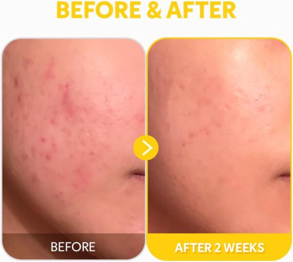 TIRTIR Pure Vitamin C 24 Face Serum – Dark Spot Remover for Sensitive Skin with Collagen Anti Aging Even Out Skin Tone Non Irritation Tested, Wrinkles, Korean Mild Vita C Facial Serum 1.01 Fl Oz 30ML